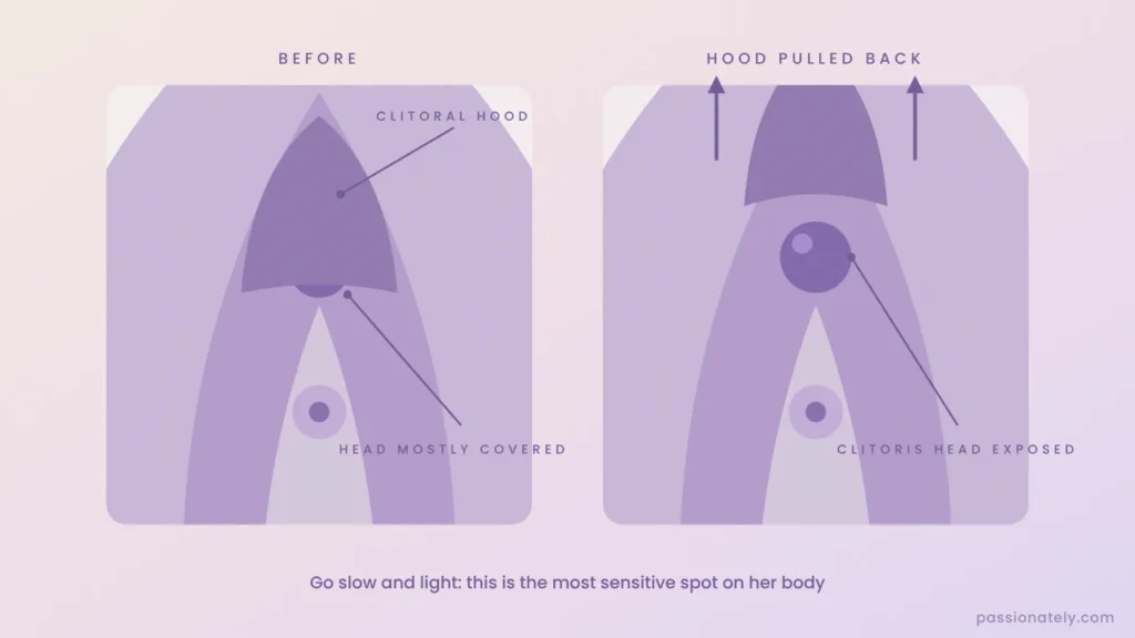 Before and after diagram of the clitoral hood covering the clitoris head, then pulled back to expose it