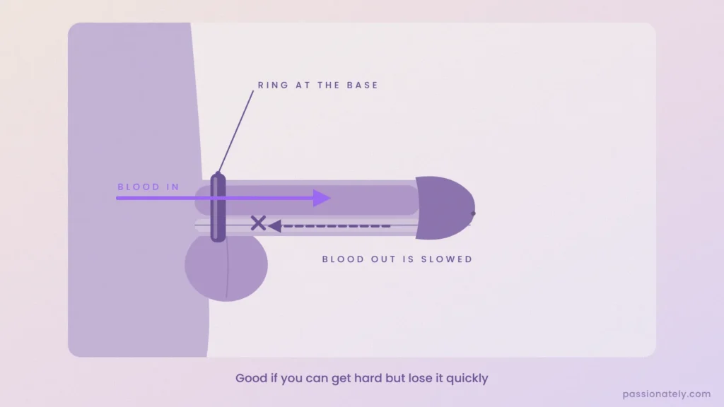 Diagram of a constriction band at the base of the penis letting blood in and slowing it flowing out