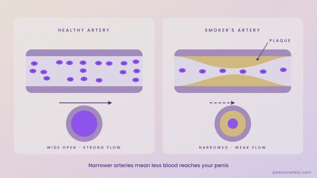 Diagram comparing a healthy artery with a smoker's artery narrowed by plaque