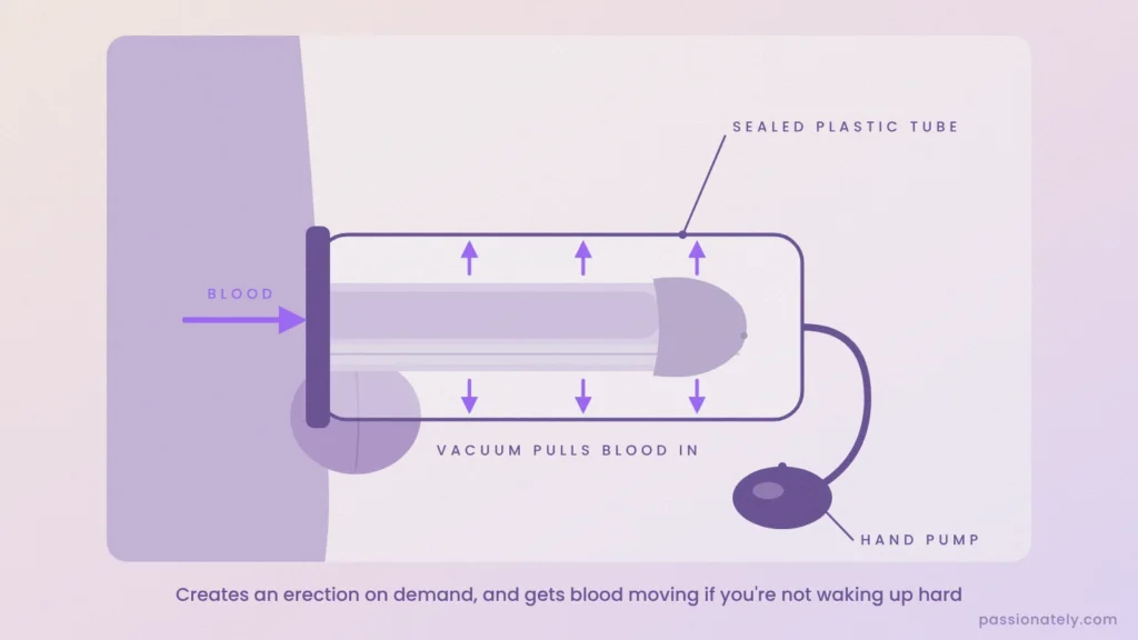 Diagram of a penis vacuum pump with a sealed tube and hand pump drawing blood into the penis