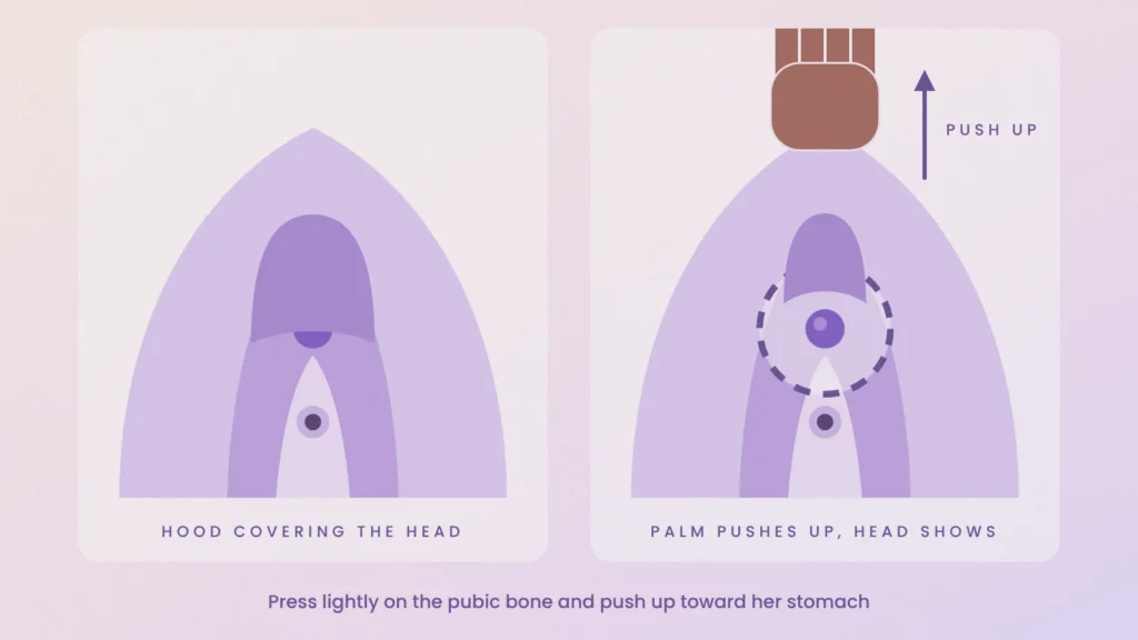 Before and after diagram of a palm pushing up on the pubic bone to pull the clitoral hood back and reveal the clitoris head