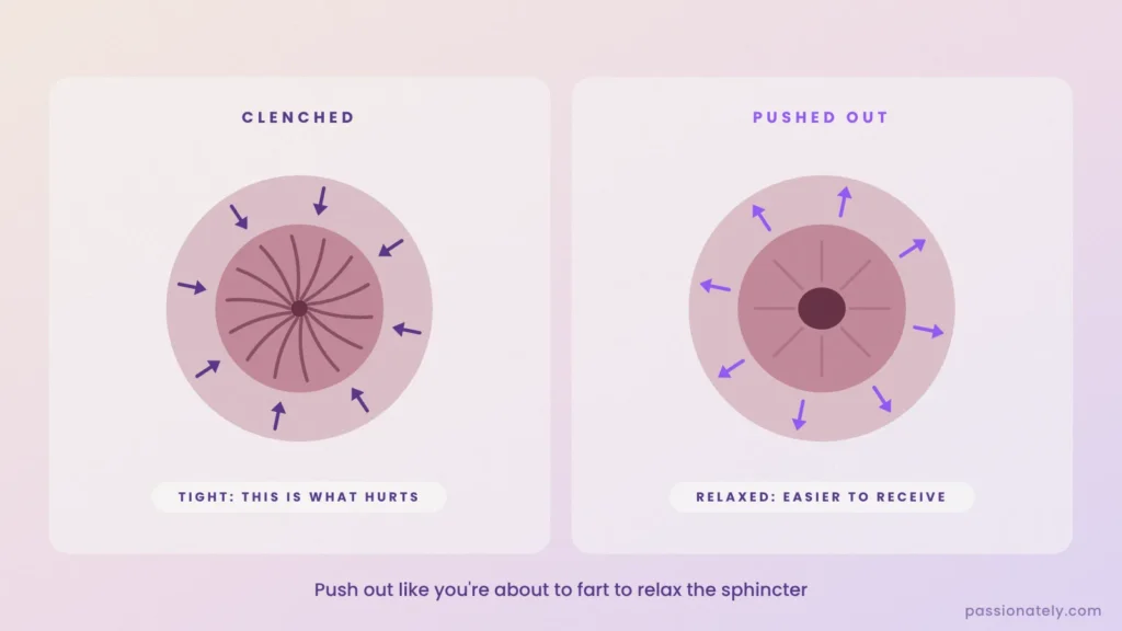 Front-view diagram of the anal sphincter clenched versus pushed out and relaxed