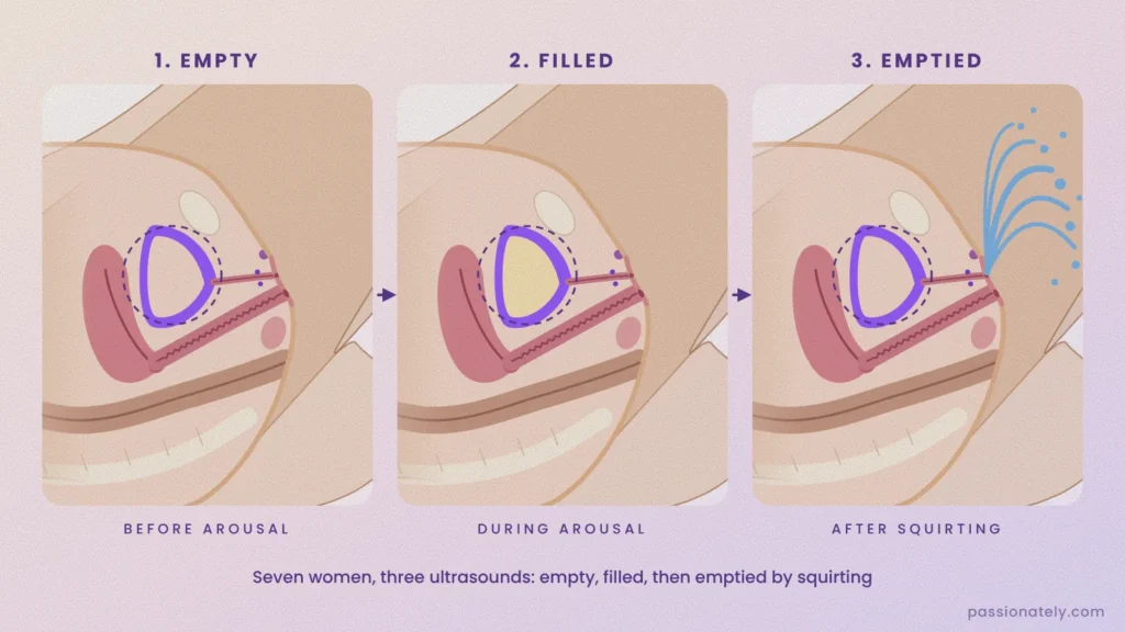 Three cross-sections showing the bladder empty before arousal, filled during arousal and emptied after squirting