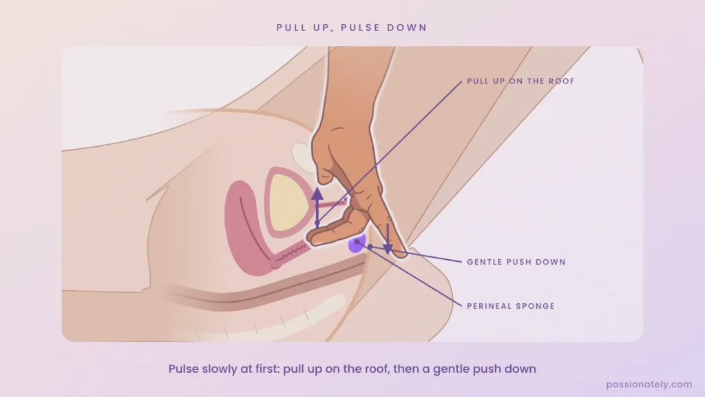 Cross-section showing the pulse: pull up on the roof of the vagina, then a gentle push down towards the perineal sponge